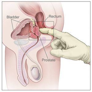Men you need to start playing with your bum! (Prostate Orgasms)