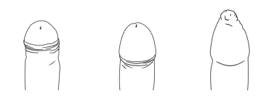 Things Every Man Can Do To Get A Stronger Erection