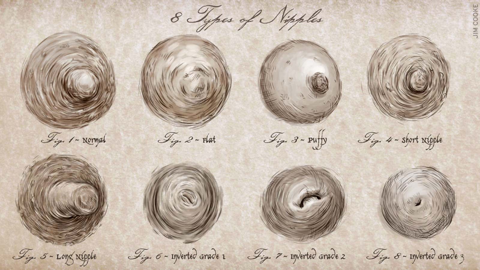 I need Answers! Are my nipples normal?